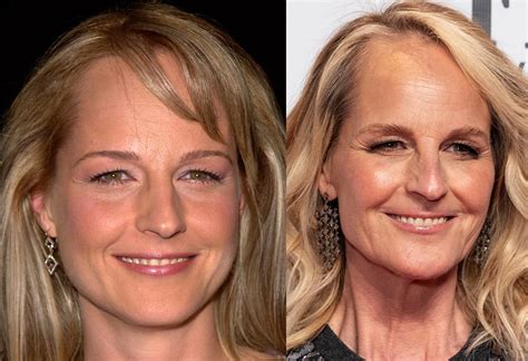 helen hunt surgery|whatever happened to helen hunt.